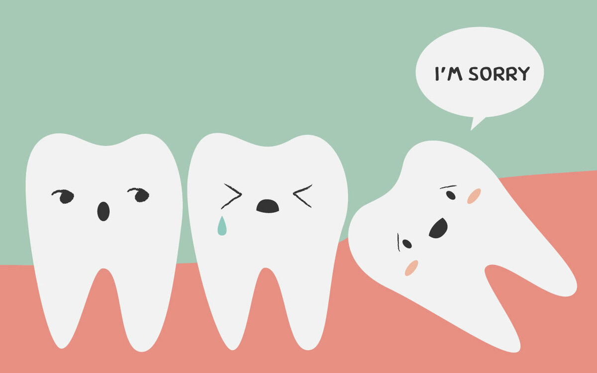   Зуб мудрости (третий моляр, «восьмерка») располагается с самого края зубного ряда. Эти зубы, в отличие от прочих, закладываются не до рождения человека, а только на 4-6 году жизни.