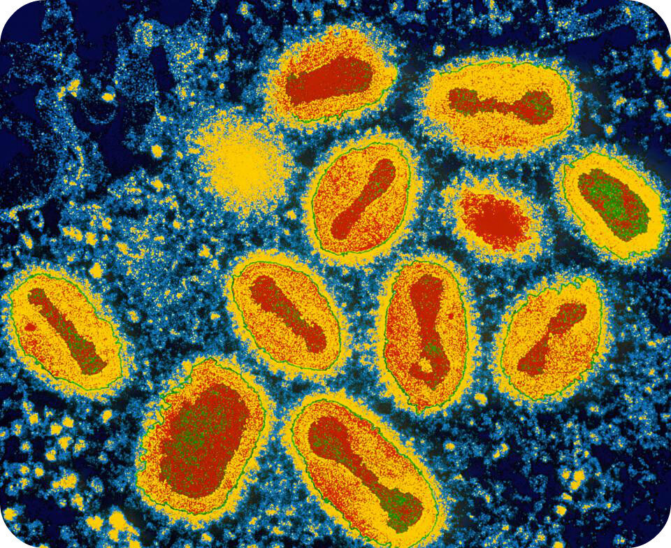 Вирус оспы под микроскопом 