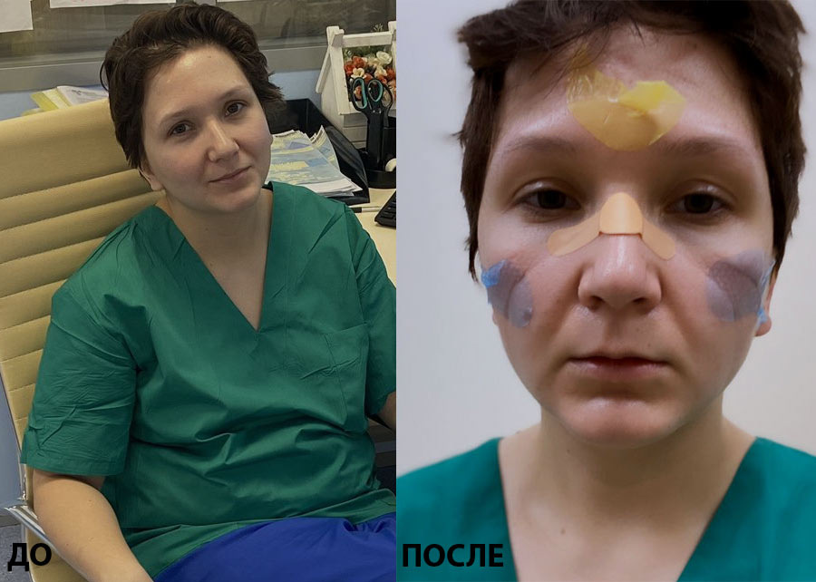 София до смены и после