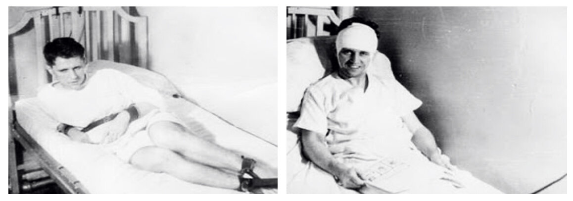 Префронтальная лоботомия. Уолтер фримен доктор лоботомия. В каких странах разрешена лоботомия. Классификация lobotomy уровни опасности. Фронтальная лоботомия.