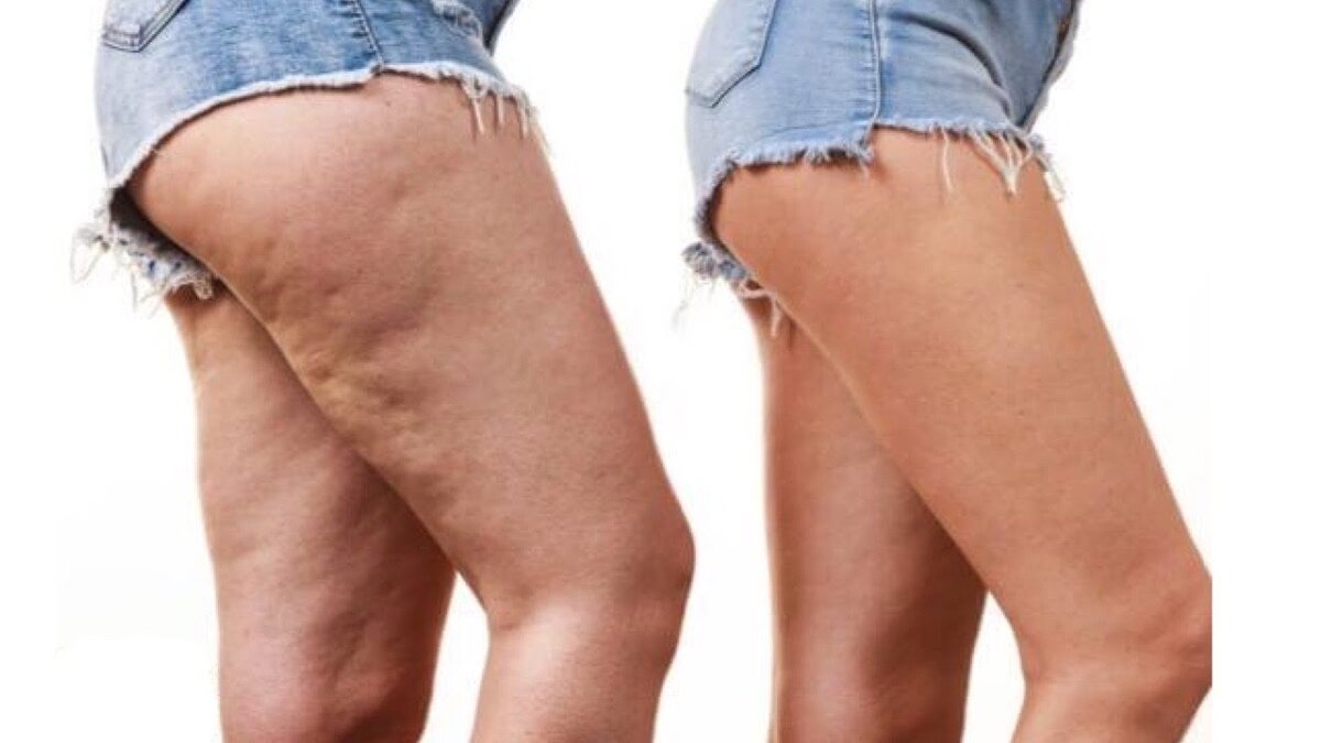 фото Яндекса