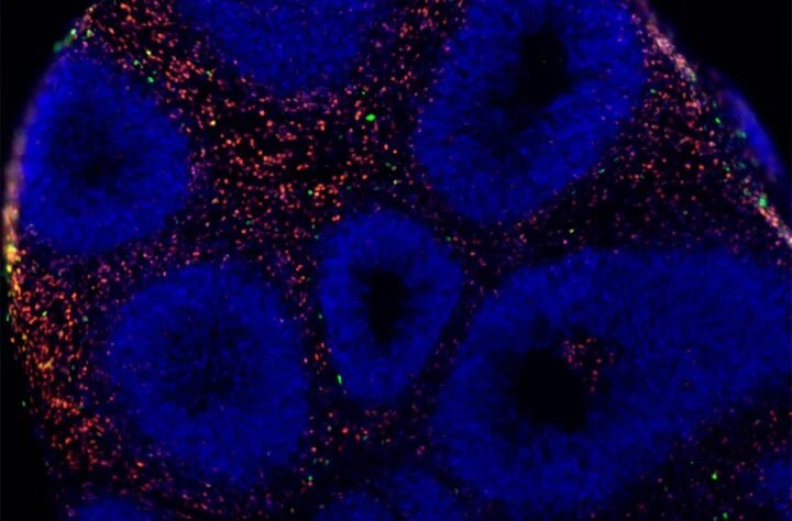 Органоид мозга, полученный из индуцированных человеком плюрипотентных стволовых клеток, который отображает ядра клеток (синий) и слои коры головного мозга (красный и зеленый). Изображение предоставлено: Пенсильванский университет