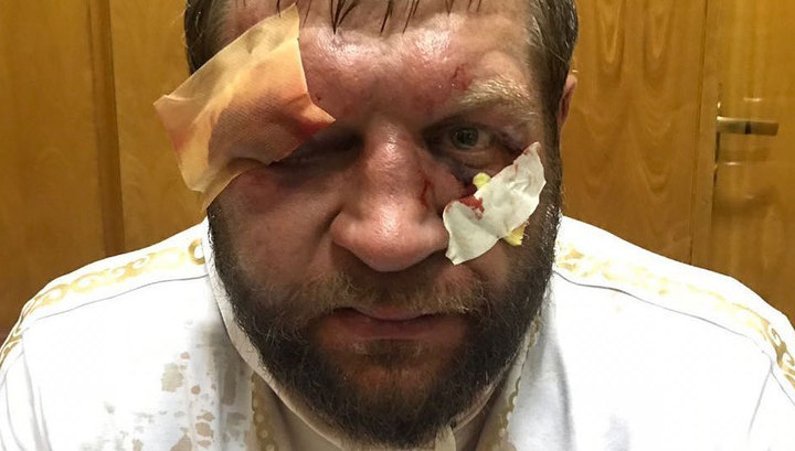 Александр Емельяненко после боя с Тони Джонсоном
