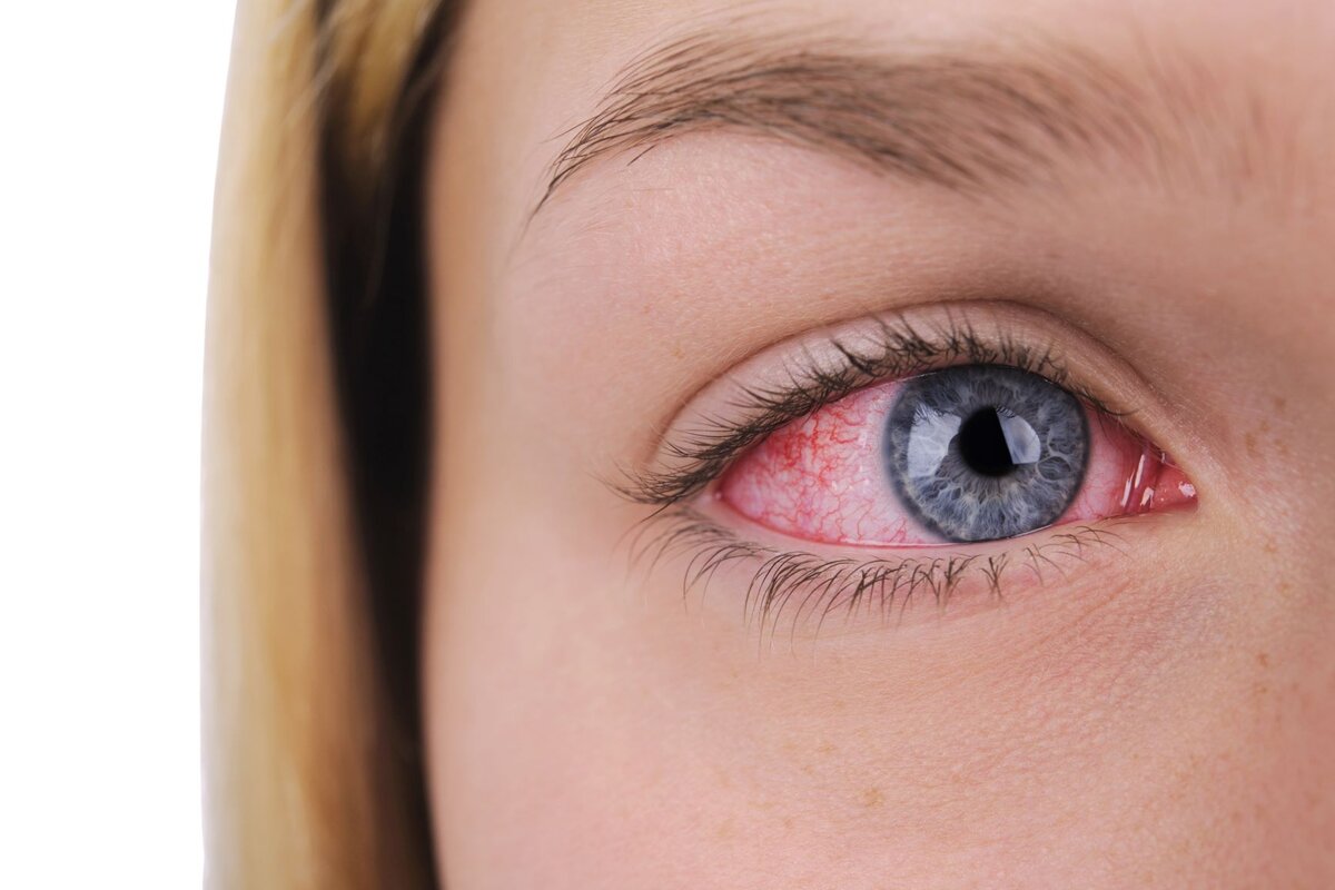 Фото из сайта mieye.com