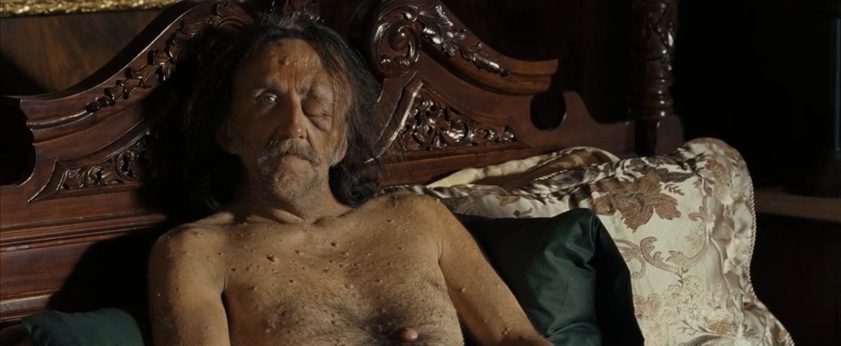 Я сначала решила, что его пчелы покусали. 