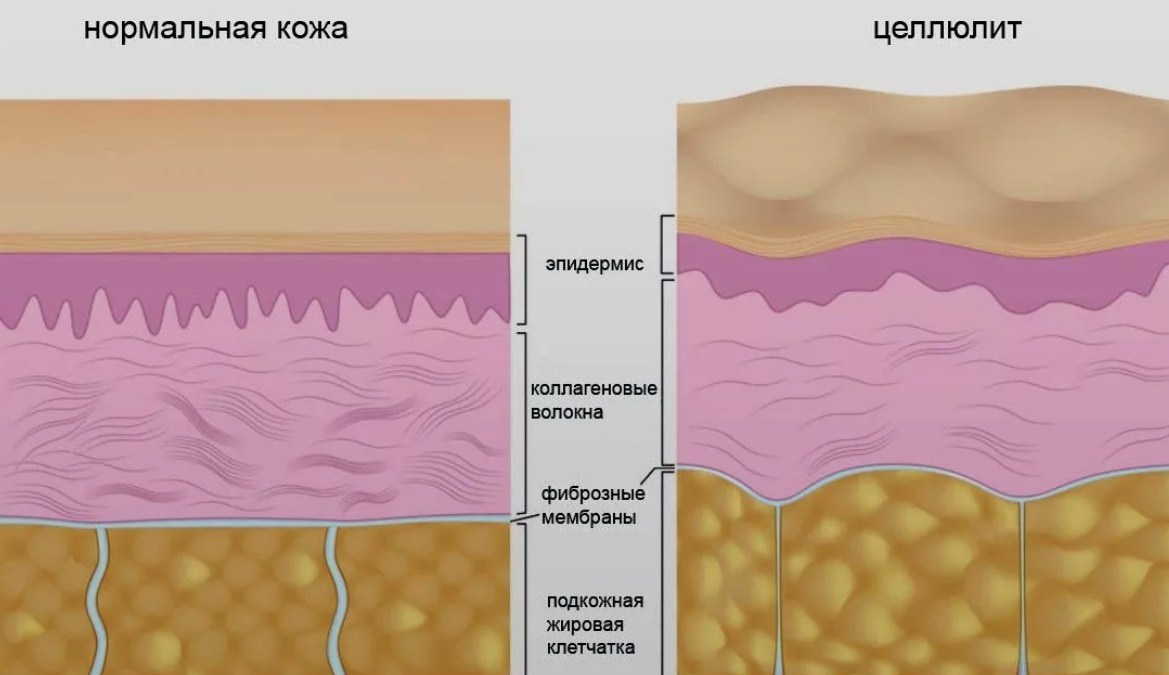 Источник Яндекс Картинки