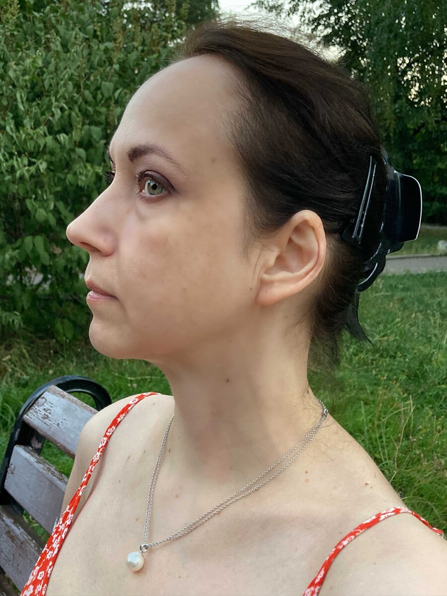 Я, на прогулке у дома неделю назад