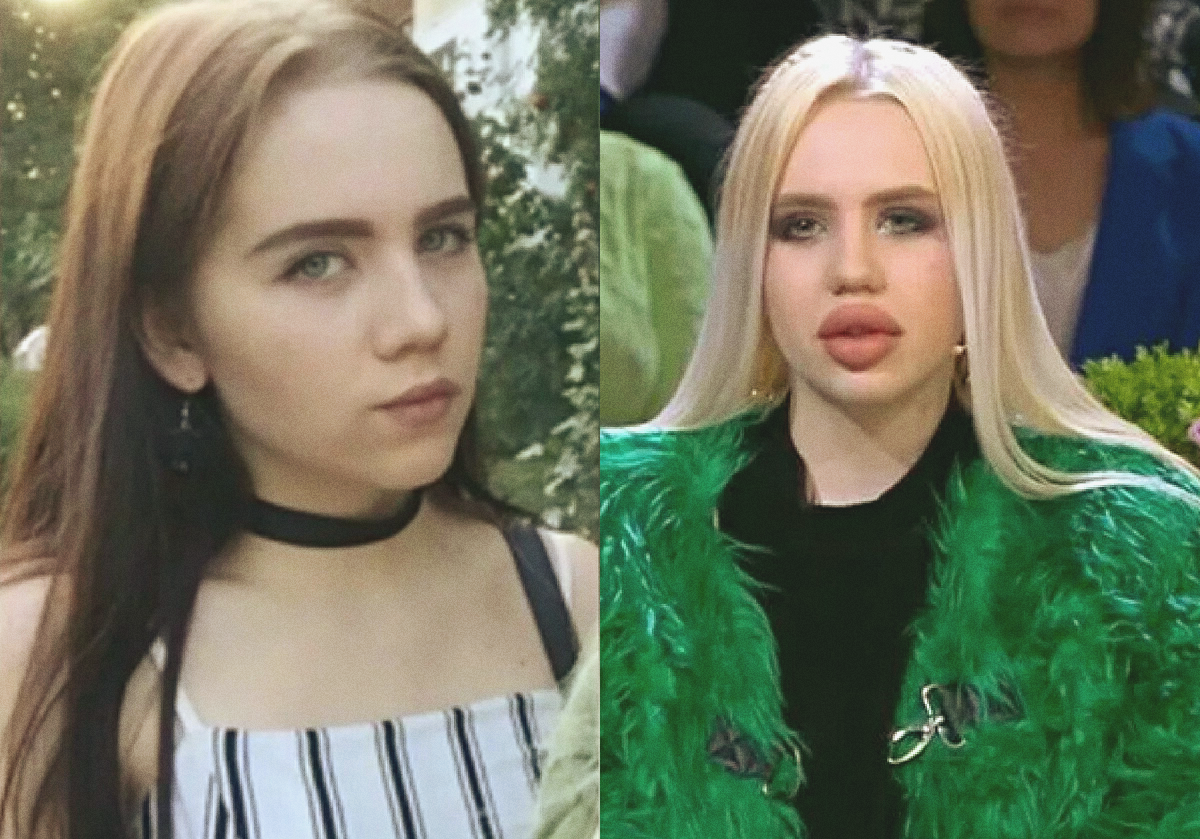 до и после операции