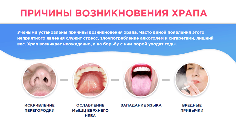Храп оказался симптомом ряда опасных заболеваний
