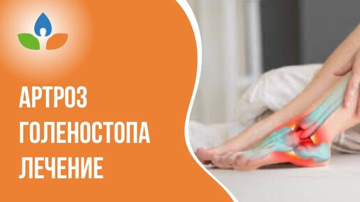 Остеоартроз голеностопа симптомы. Артроз голеностопного сустава Остеоартроз коленного сустава: симптомы и лечение, причины, степени Артроз голеностопного сустава: причины и симптомы болезни, диагностика.