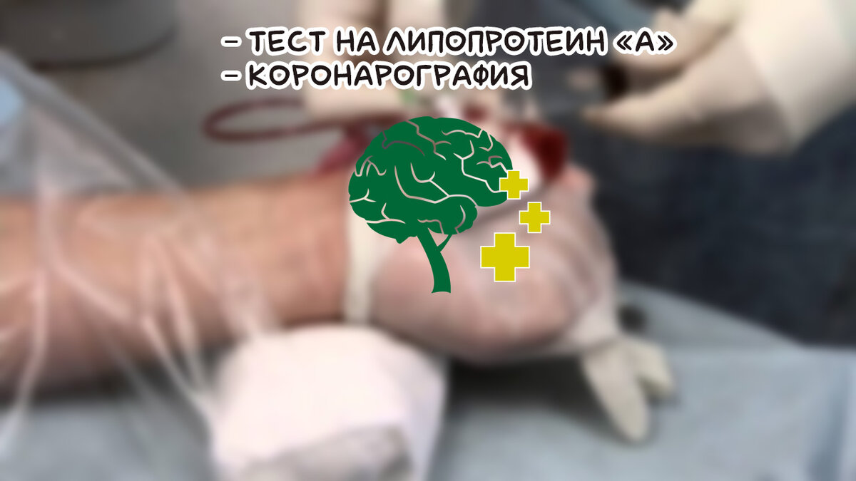 Анализ сосудов