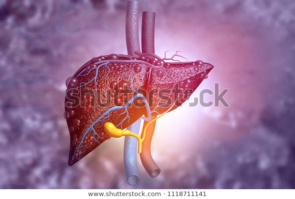 https://www.shutterstock.com/image-illustration/3d-illustration-abstract-medical-background-diseased-1118711141?irgwc=1&utm_medium=Affiliate&utm_campaign=Pixabay+GmbH&utm_source=44814&utm_term=https%3A%2F%2Fpixabay.com%2Fru%2Fimages%2Fsearch%2F%25D0%25BF%25D0%25B5%25D1%2587%25D0%25B5%25D0%25BD%25D1%258C%2F