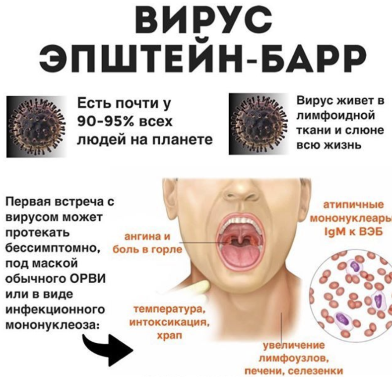 герпес 4 го типа. Gammaherpesvirinae методы. вирус эпштейна-барр мононуклеоз. инфекционный мононуклеоз (вирус эпштейна-барр). герпес 4 го типа.