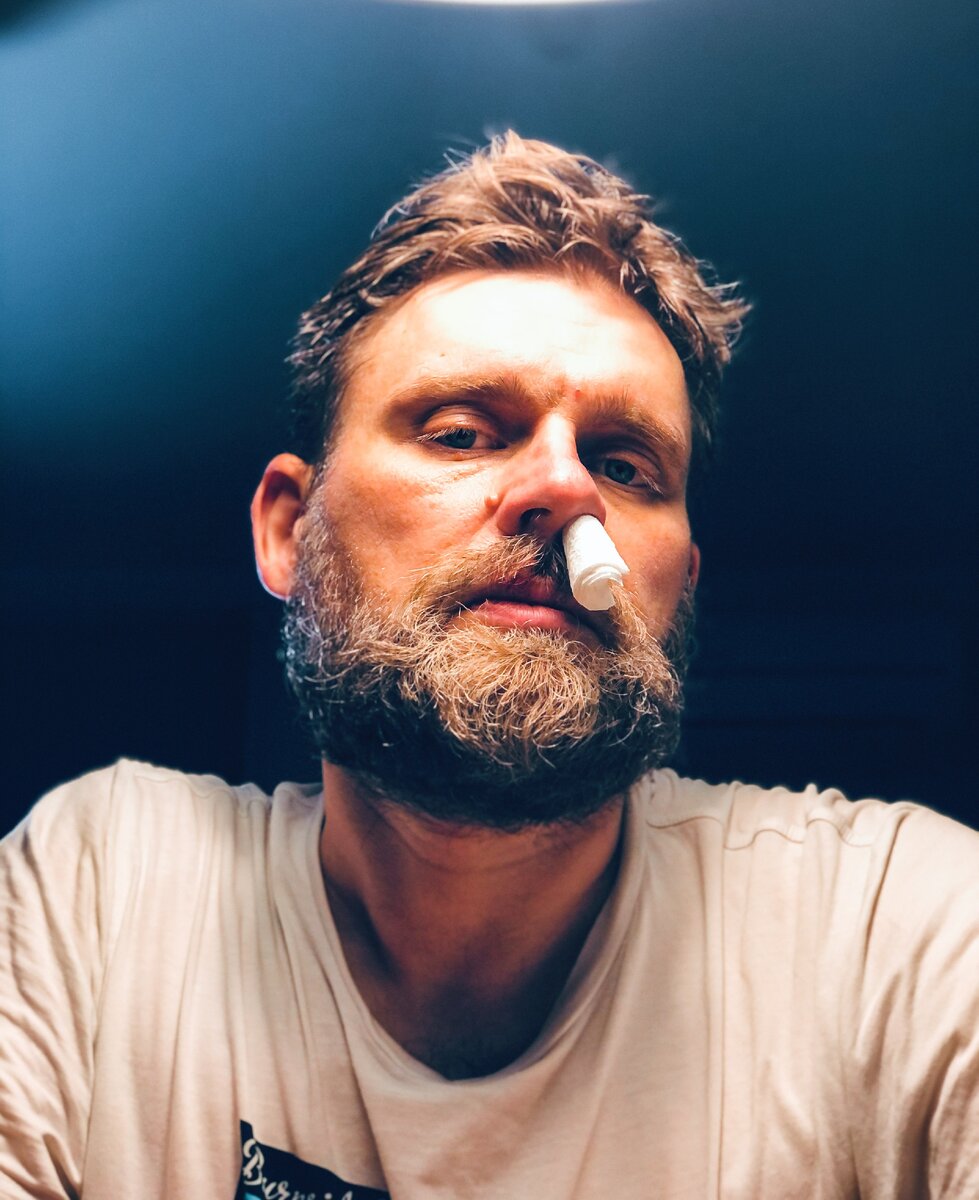 В последнее время начала идти носом кровь. Тоже симптом.