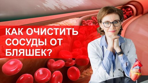 Как очистить сосуды от холестериновых бляшек?