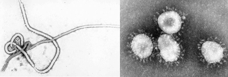 Разница в строении между Эболой и SARS-CoV-2 под микроскопом.