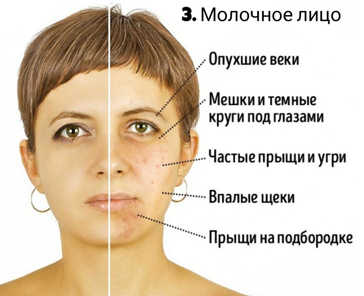 И первое, что нужно изменить к лучшему – это питание. 