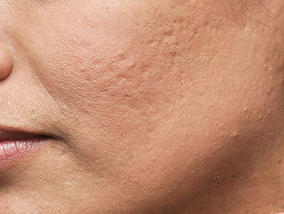 Источник: Яндекс Картинки