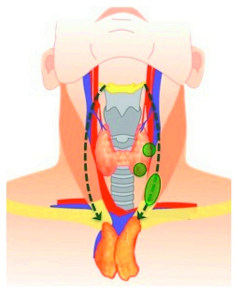 Схема миграции тимусной ткани