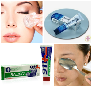 Синяк под глазом рекомендуется лечить листьями подорожника или горькой полыни. Свежие листья измельчаются до появления сока. Смесь прикладывается на кровоподтек толстым слоем и держится до впитывания сока. Для скорейшего избавления от синяка под глазом можно использовать и семена льна, которые предварительно нагреваются в воде и заворачиваются в бинт. Чуть теплый компресс прикладывается прямо на гематому. 