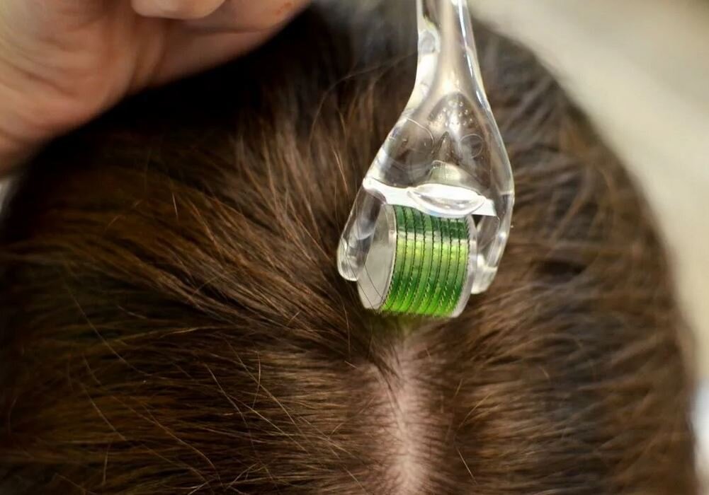 Скальпроллер для головы