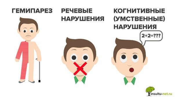 Последствия инсульта.