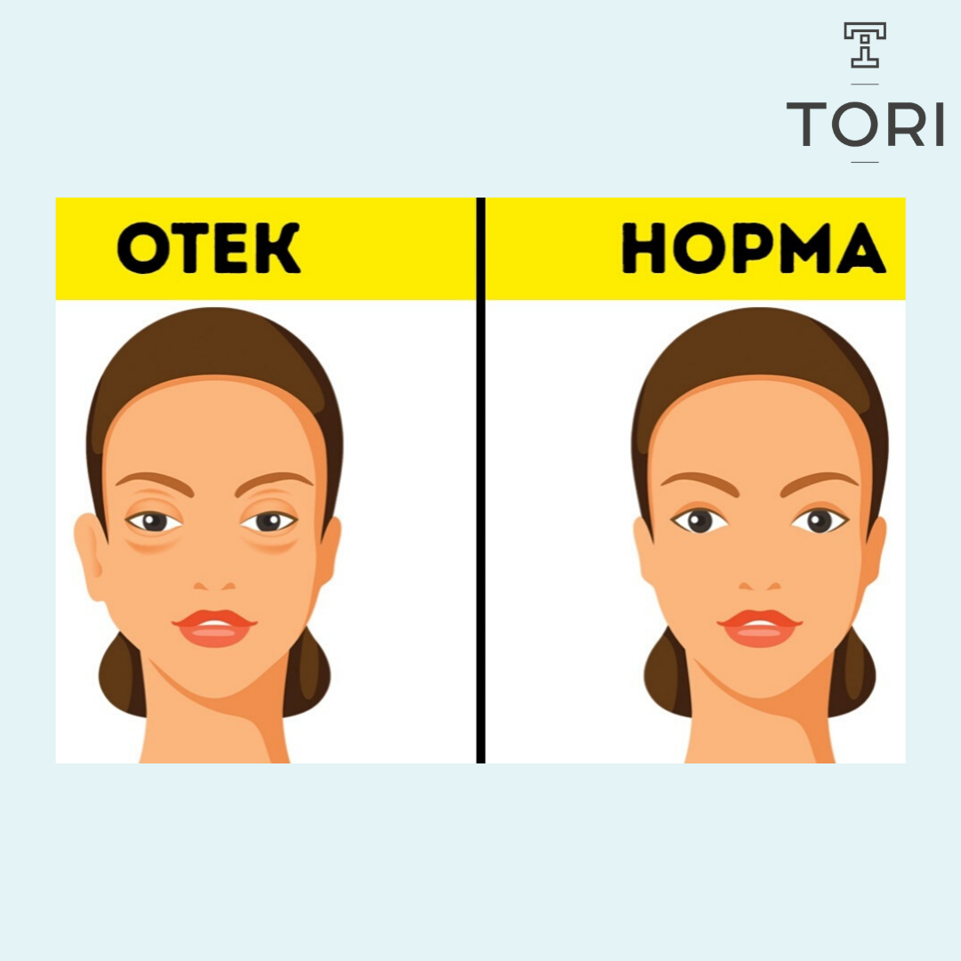 как быстро убрать отек с лица после удара
