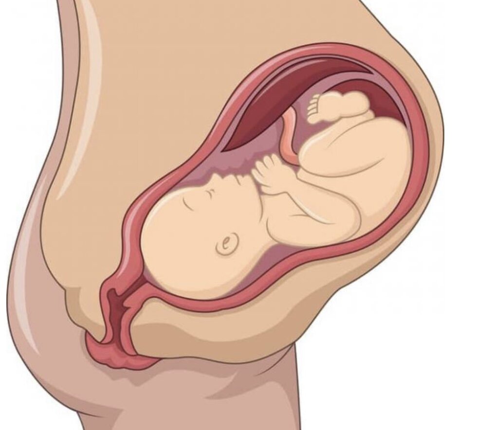 фото продольного предлежания плода