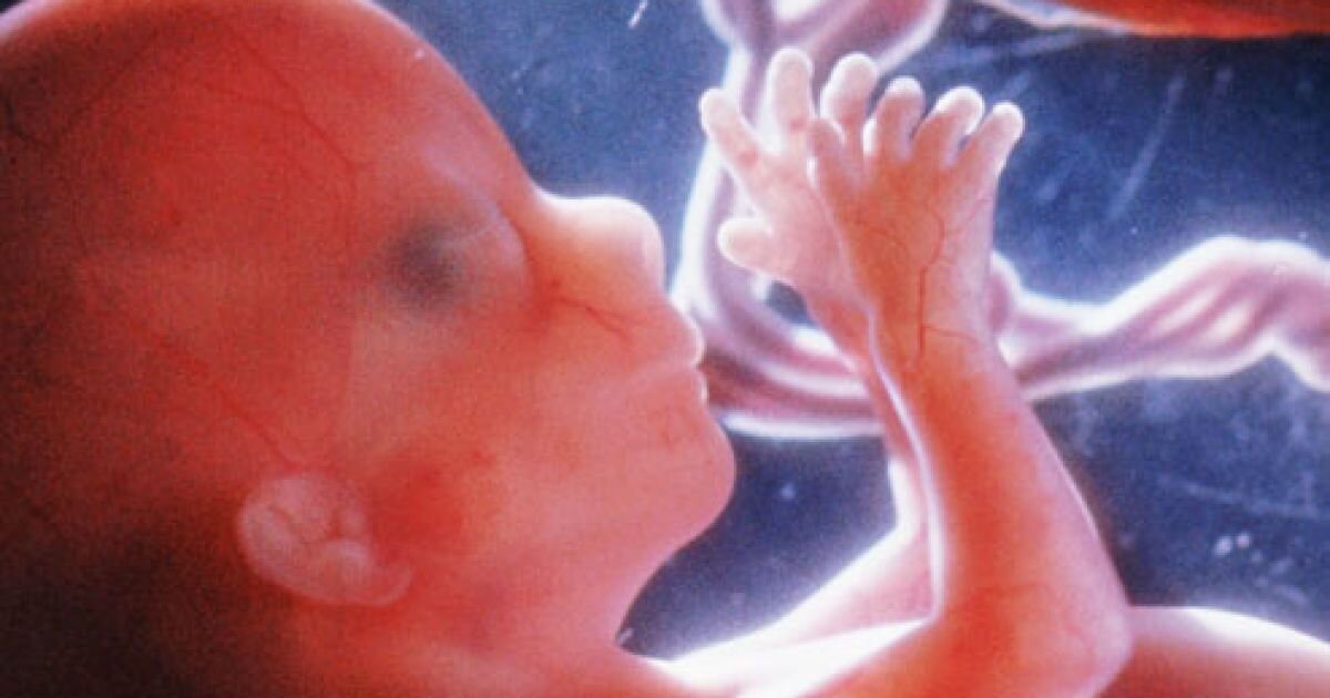 Высокое давление у беременных вредит плоду