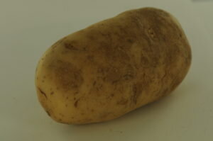 Симптомы сплющивания давления: впадина и депрессия