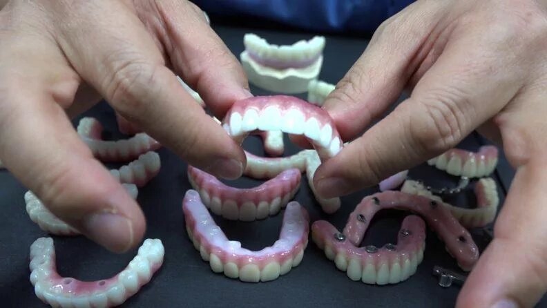 Зубные протезы All on 4