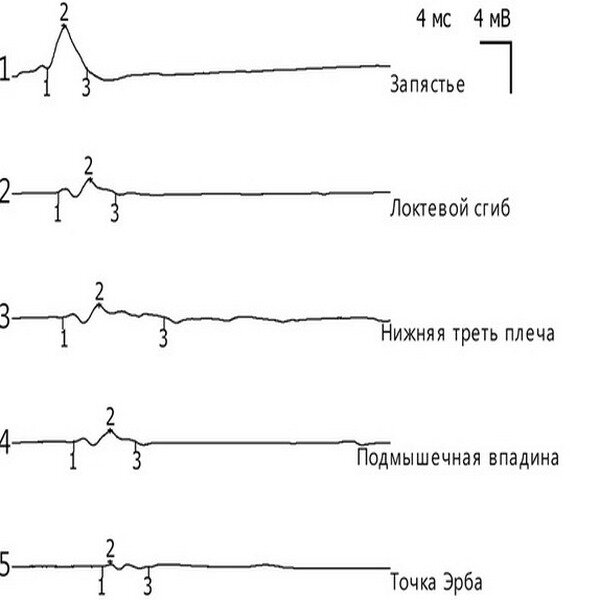 https://www.mediasphera.ru/issues/zhurnal-nevrologii-i-psikhiatrii-im-s-s-korsakova/2016/6/1199772982016061070