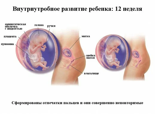 Источник: https://moydiagnos.ru