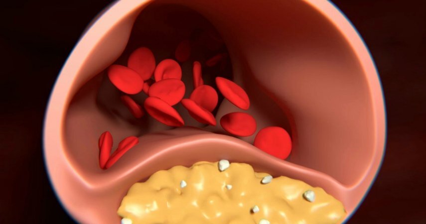 картинка взята с сервиса яндекс картинки