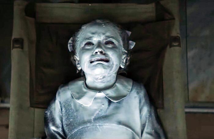 Девочка просто в краске, ничего страшного :)