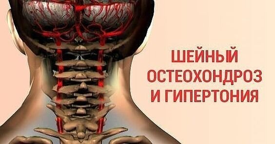 источник:https://za.pinterest.com/pin/234609461826373606/