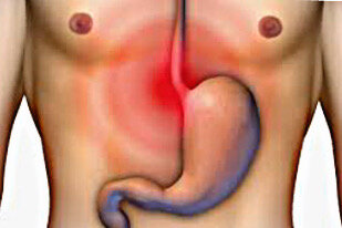 Боль в желудке.