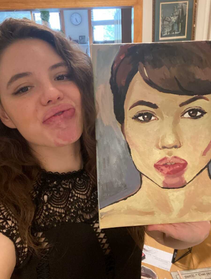 https://www.lovewhatmatters.com/woman-normalizing-unique-birthmarks-port-wine-stain-kindness-art-painting/