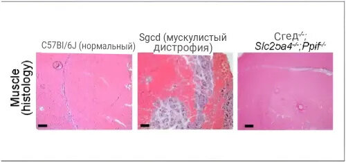 При индуцировании мышечной дистрофии в мышиной модели (в центре) появляются повреждения мышечной ткани. Однако при отсутствии в мышиной модели двух генов, контролирующих образование митохондриальных пор, мышечная ткань становится очень похожей на нормальную (справа). Credit: Cincinnati Children's