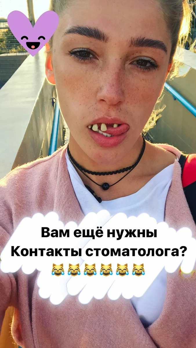 Виниры стоят дорого, и Настя сама рассказывала, откуда у неё такая белоснежная улыбка. Богатый знакомый предоставил девушке некоторую сумму денег бескорыстно, чтобы она смогла открыть собственный бизнес. Но, как признается Ивлеева, половину денег она прогуляла, а на оставшуюся часть сделала себе голливудскую улыбку. 
