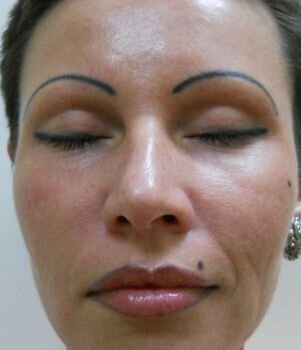 Синие «чайки» над глазами пугают мужчин.