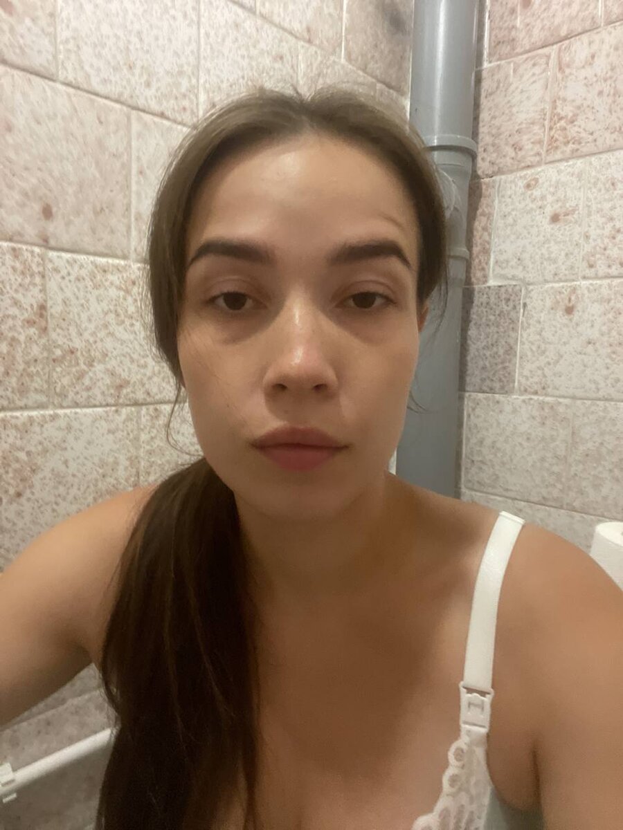 06.08 в 20:00 начались схватки. Здесь 07.08 около 12 часов дня, а раскрытие не происходит 