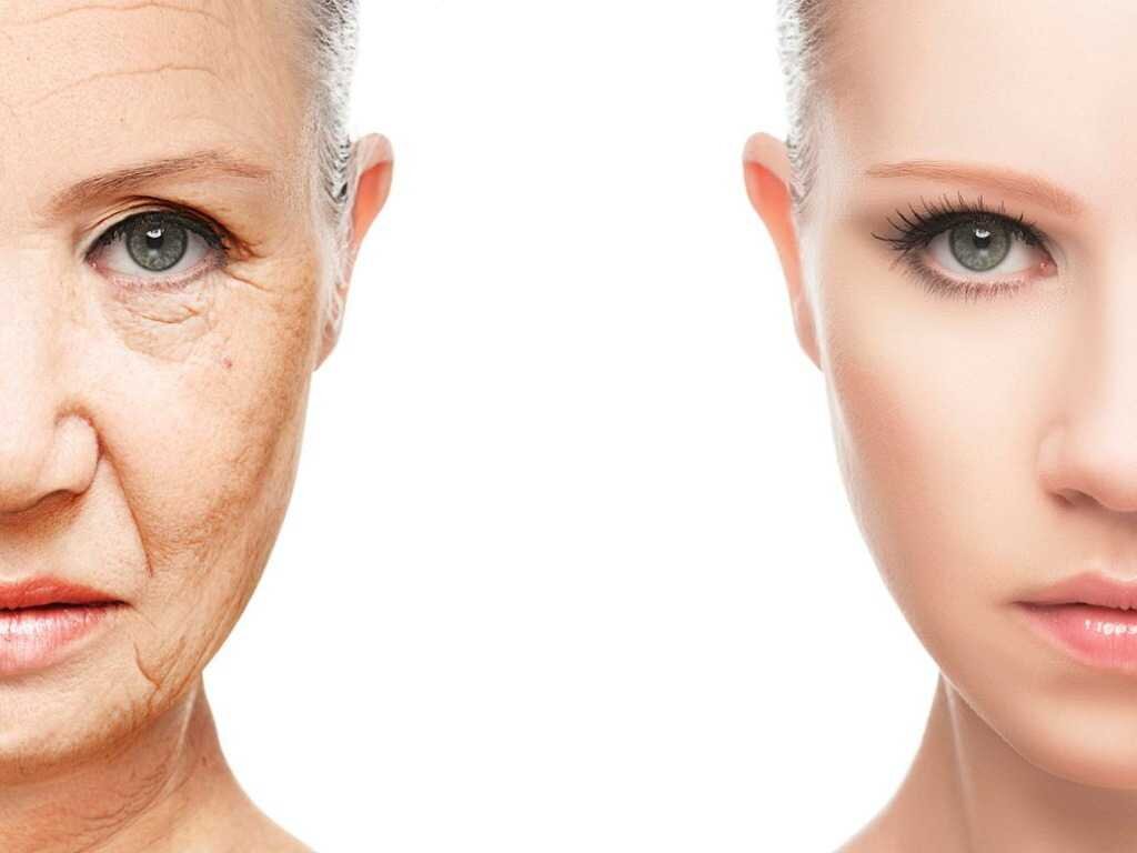 возрастные изменения кожи лица. морщины на лице. старение кожи. возрастные изменения кожи лица. старение кожи лица у женщин.
