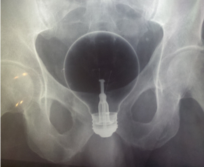 Фото: сайт Radiopaedia