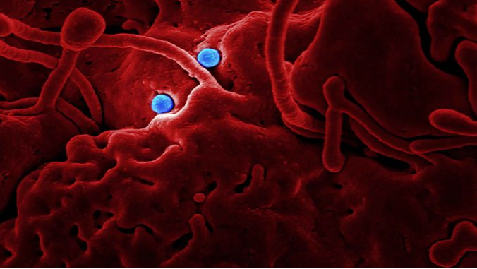 фото с сайта healtheyo.com