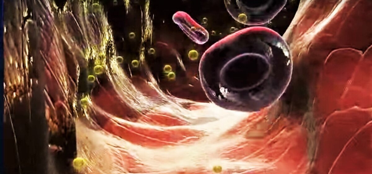 Как нормализовать артериальное давление при перелете?