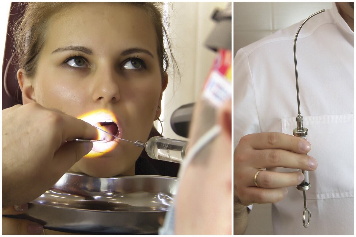 Вливание в гортань из шприца в "Лор Клинике Доктора Зайцева"