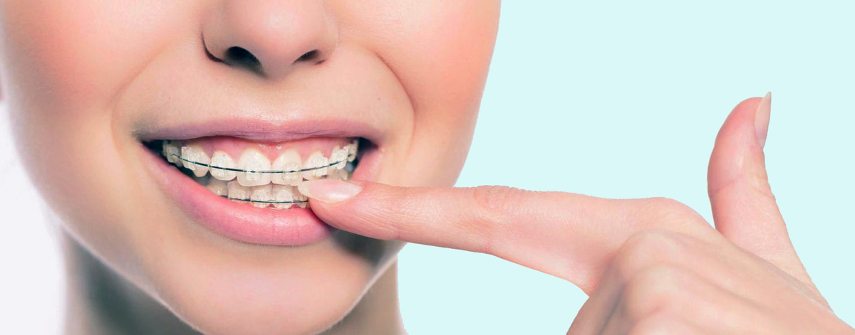 источник - http://www.zubokey.ru