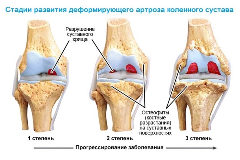 Оа 1 степени