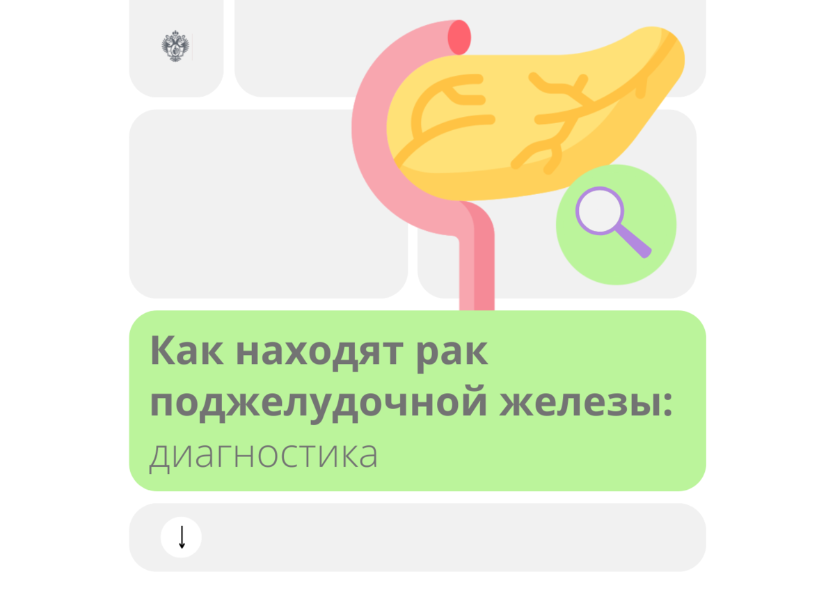 Как находят рак поджелудочной железы: диагностика | Клиника Пирогова ...